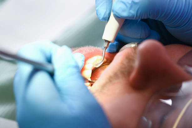 Best Weekend Emergency Dentist in Wilmington, NC