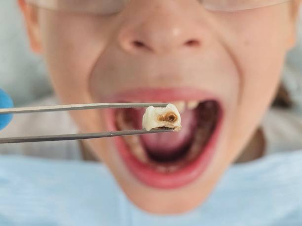 Best Pediatric Emergency Dentist in Wilmington, NC